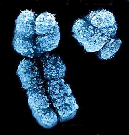 Ychromosome